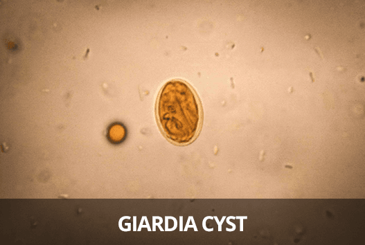 giardia in human poop